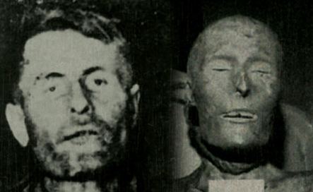Head parts of the mummified body of Elmer McCurdy.