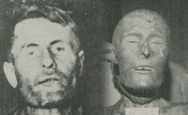 Head parts of the mummified body of Elmer McCurdy.