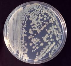 Enterobacter cloacae httpsuploadwikimediaorgwikipediacommonsthu