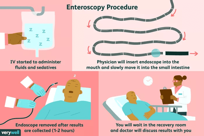 Enteroscopy Enteroscopy