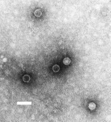 Enterovirus C
