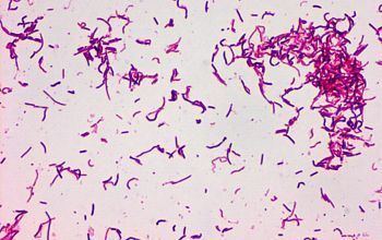 Erysipelothrix microbecanvascomadminuploadsimagebacteriene