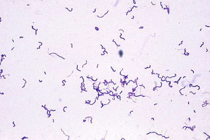 Erysipelothrix rhusiopathiae Photo Gallery of Pathogenic Bacterial