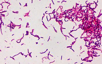 Erysipelothrix rhusiopathiae microbecanvascomadminuploadsimagebacteriene