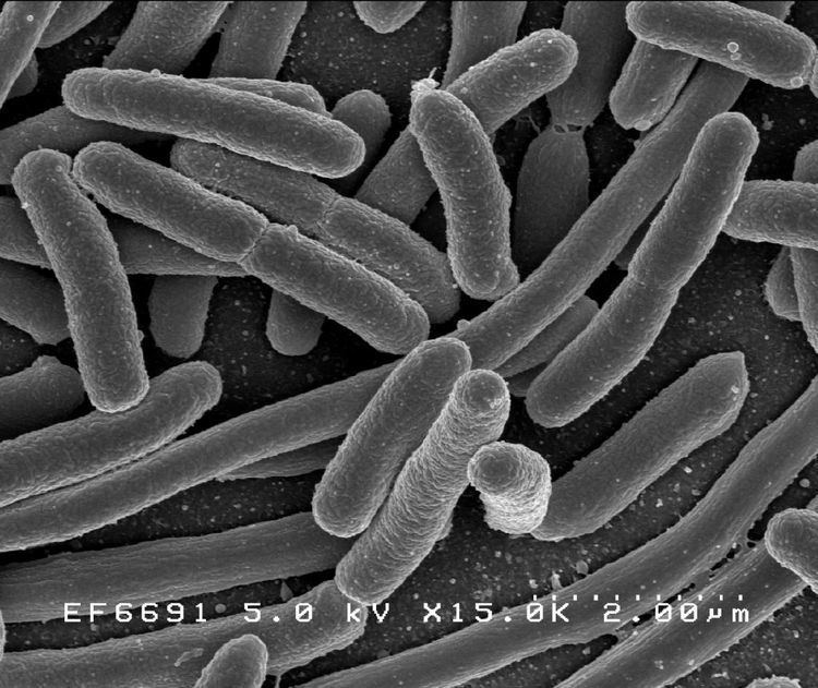 Escherichia coli O104:H21