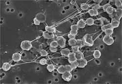 Euryarchaeota Archaebacteria Classification