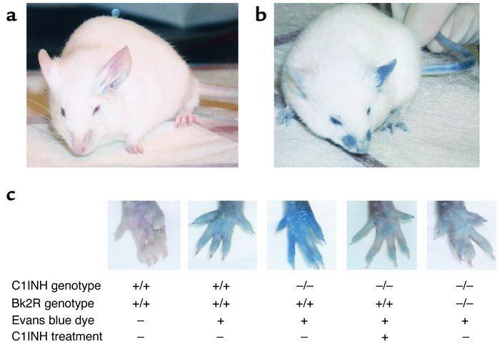 Evans Blue (dye) JCI Increased vascular permeability in C1 inhibitordeficient mice