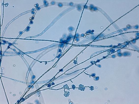 Exophiala Fun With Microbiology What39s Buggin39 You Exophiala dermatitidis