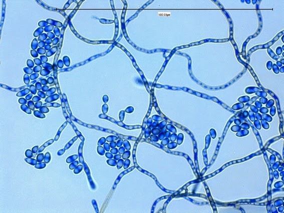 Exophiala jeanselmei Fun With Microbiology What39s Buggin39 You Exophiala jeanselmei