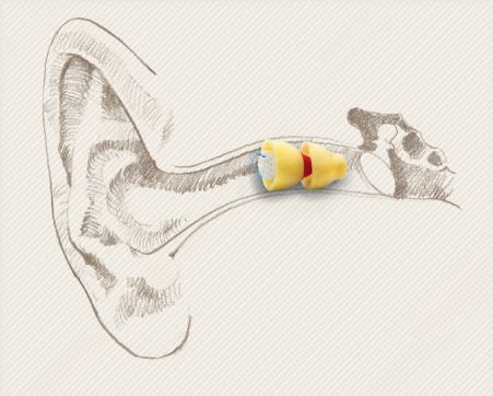 Extended-wear hearing aid