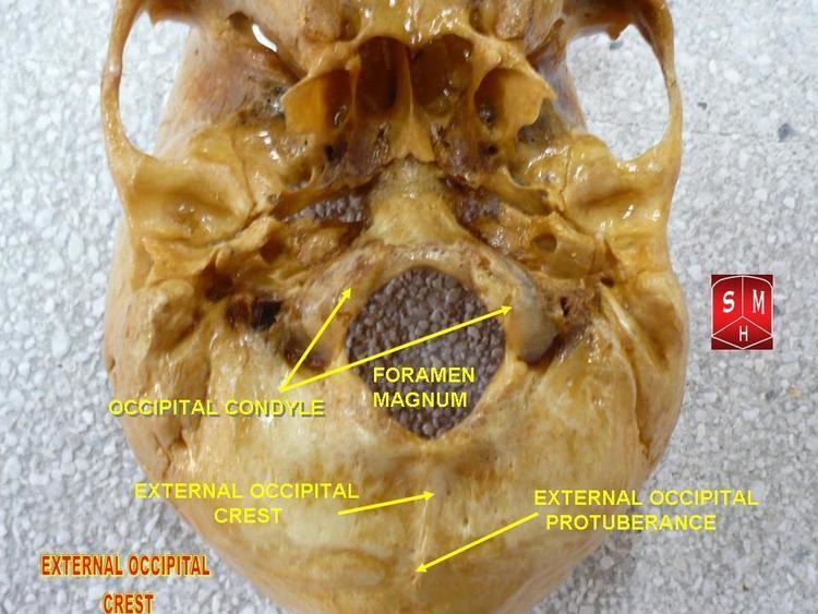 External occipital crest
