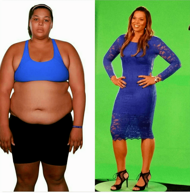 Extreme Weight Loss The Kansas City Star