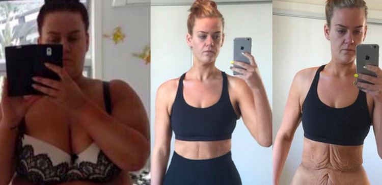 Extreme Weight Loss Woman39s Selfie Makes an Important Point About the Reality of Extreme