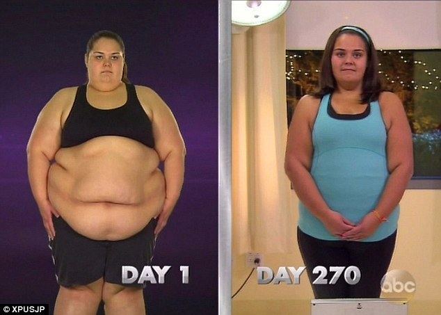 Extreme Weight Loss Extreme Weight Loss contestant drops half her body weight to 212lb
