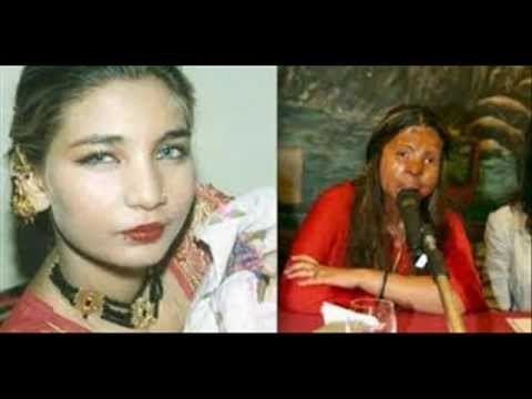 Fakhra Younus Acid attack victim Fakhra Younus commits suicide in Italy
