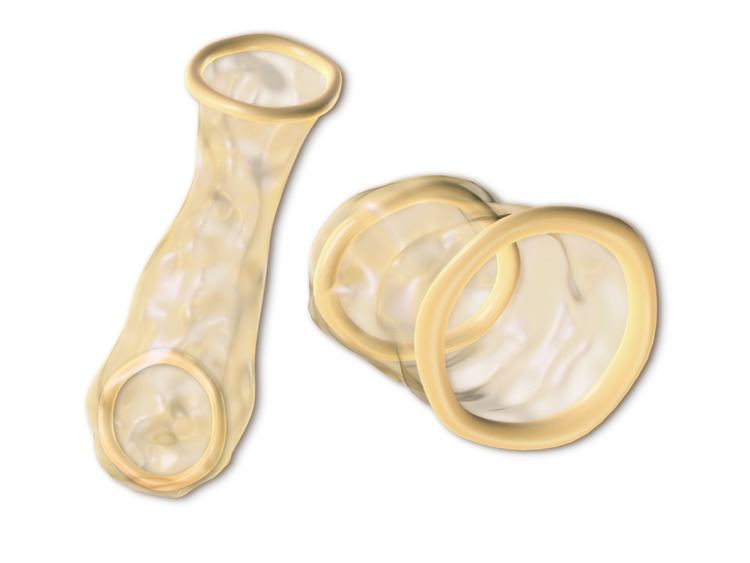 Female condom