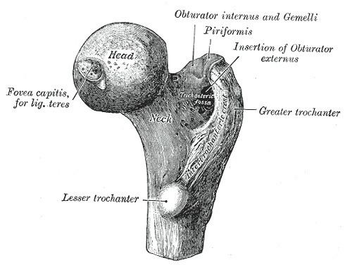 Femoral head ostectomy
