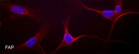 Fibroblast activation protein, alpha AntiFibroblast activation protein alpha antibody ab53066