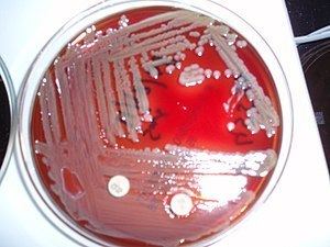 Flavobacteriaceae httpsuploadwikimediaorgwikipediacommonsthu