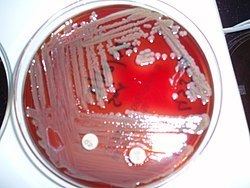 Flavobacteriia httpsuploadwikimediaorgwikipediacommonsthu