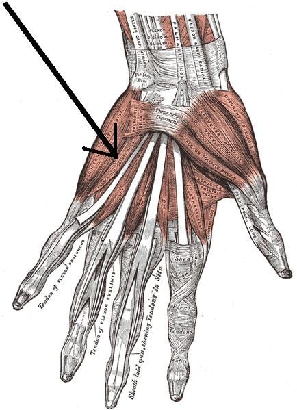 Flexor digiti minimi brevis muscle (hand)