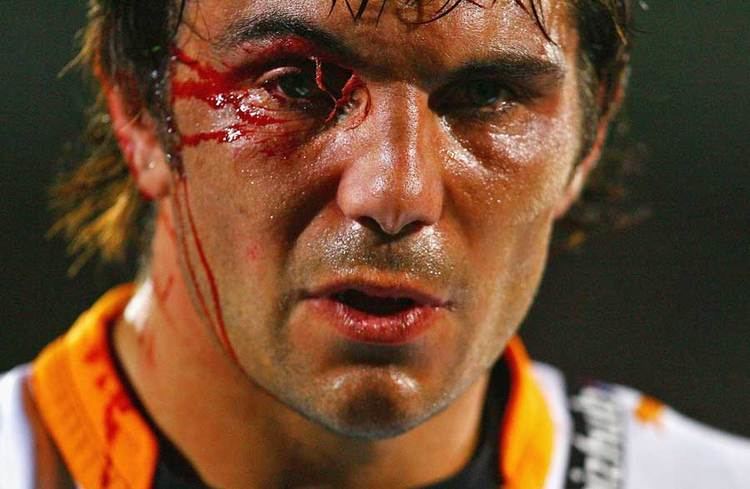 Francois Uys The Cheetahs39 Francois Uys dispays a battle wound Rugby