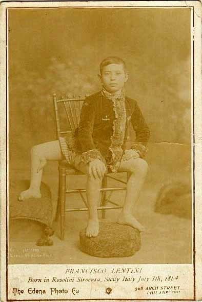 Young Frank Lentini sitting on a chair with pillows under his feet, a serious face, and some basic information about him on the bottom part of an old photograph. Frank is wearing a coat and shorts
