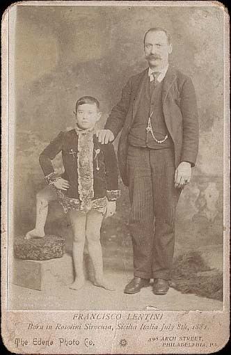 Young Frank Lentini standing beside the man while his left foot is on the top of a rock, the man's hand is on Frank's shoulder, and some basic information about him on the bottom part of an old photograph. Frank is wearing a long sleeve while the man beside him, with a mustache, is wearing pants, shoes, and a long sleeve under a vest and coat.
