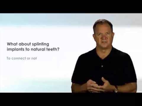 Frank Spear The Spear Education Series on Dentaltown Connecting Teeth