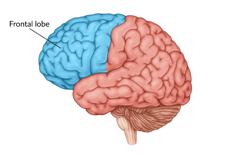 Frontal lobe disorder Frontal lobe disorder