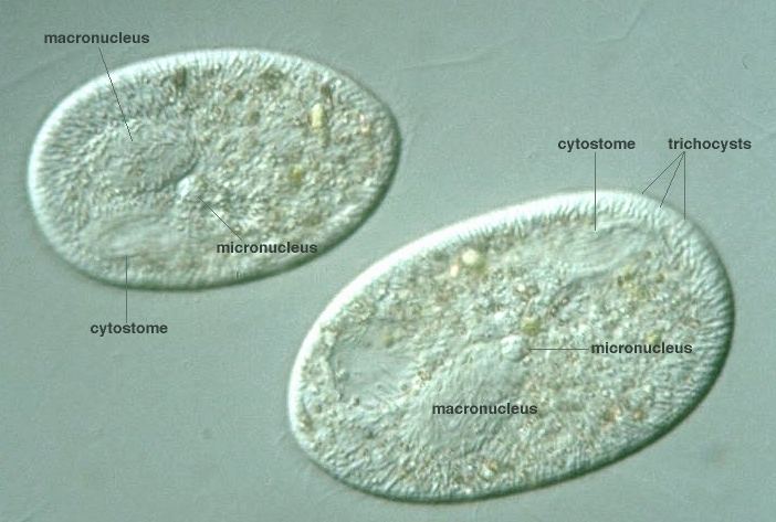 Frontonia Protist Images Frontonia acuminata