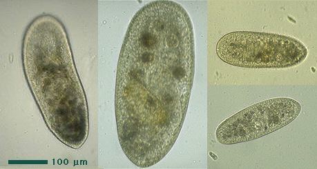 Frontonia Protist Images Frontonia