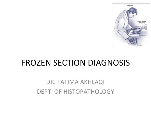 Frozen section procedure Frozen section