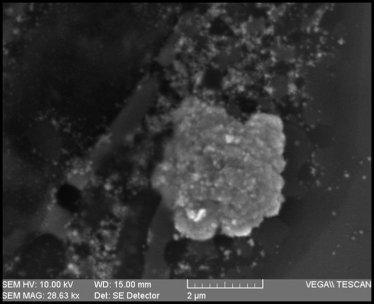 Fungal-derived nanoparticles