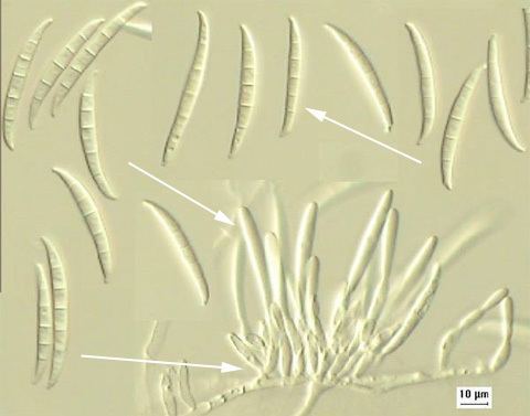 Fusarium Fusarium head blight