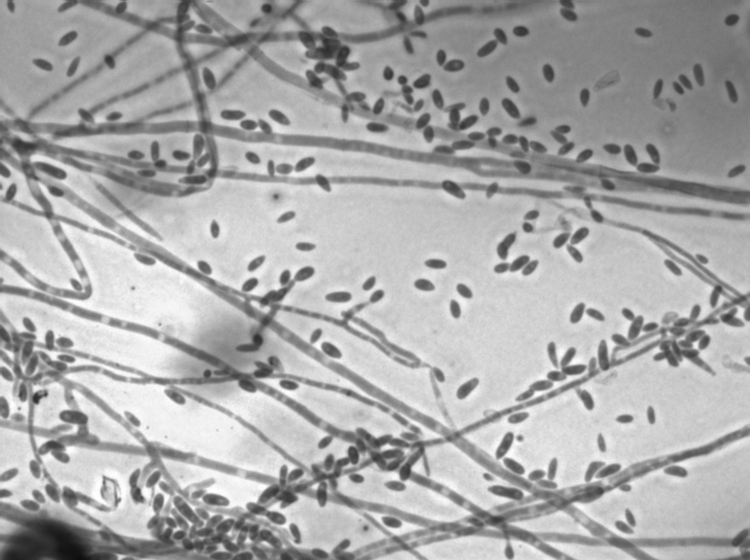 Microscopic appearance of Fusarium oxysporum