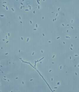 Fusarium subglutinans fusarium1JPG