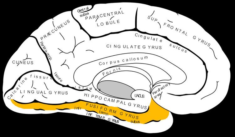 Fusiform gyrus