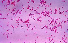 Fusobacteria httpsuploadwikimediaorgwikipediacommonsthu