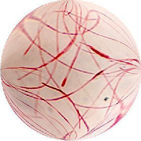 Fusobacterium Fusobacterium MicrobeWiki