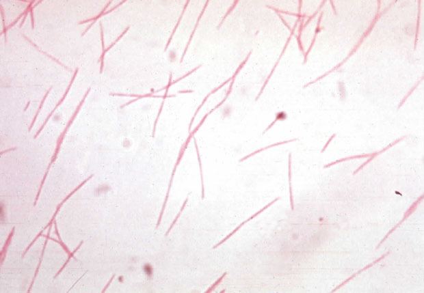 Fusobacterium Fusobacterium nucleatum MicrobeWiki