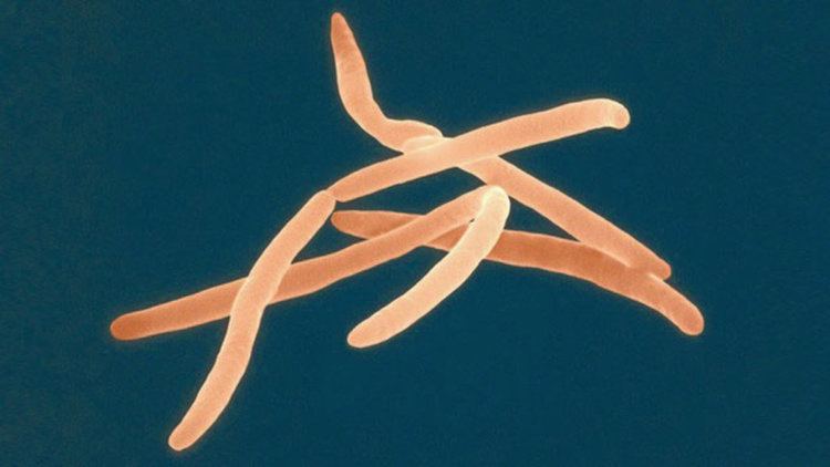 Fusobacterium Colorectal Cancer A Bacterial Disease Big Think