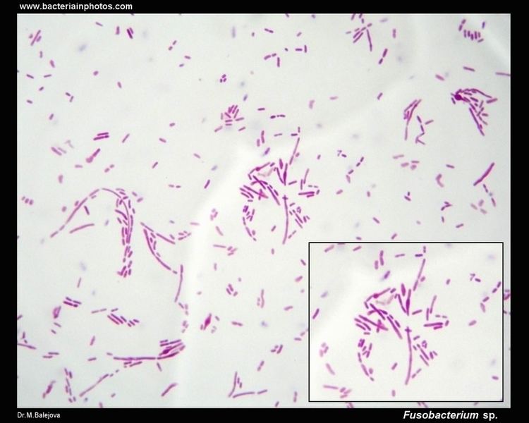 Fusobacterium Fusobacterium