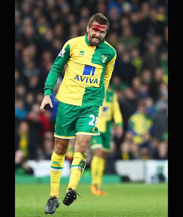 Gary O'Neil Gary O39Neil Norwich players sustain gruesome head injuries