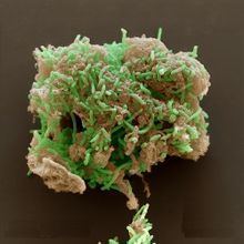 Geobacter sulfurreducens httpsuploadwikimediaorgwikipediacommonsthu