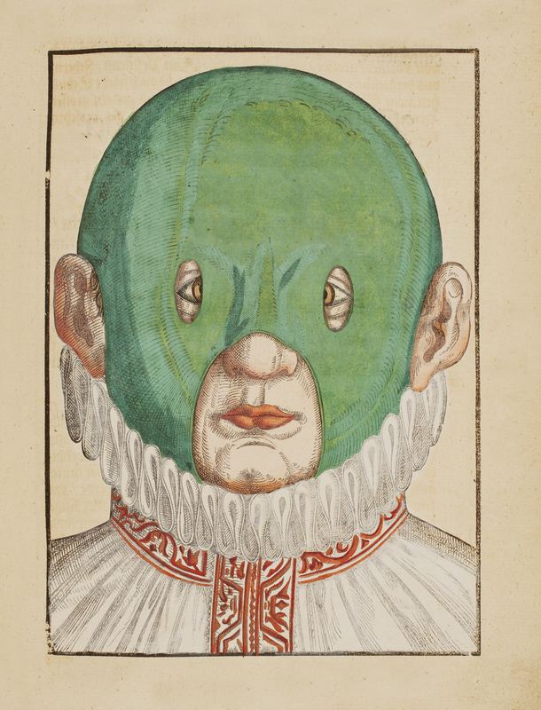 Georg Bartisch Crosseyed child with a squinting hood Wunderkammer