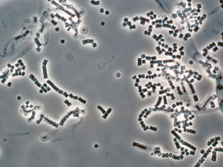 Geotrichum Geotrichum candidum boxshaped hyphal segments