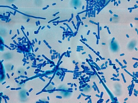 Geotrichum Fun With Microbiology What39s Buggin39 You Geotrichum candidum