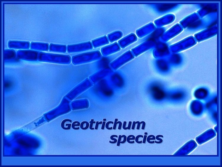 Geotrichum Fun With Microbiology What39s Buggin39 You Geotrichum candidum