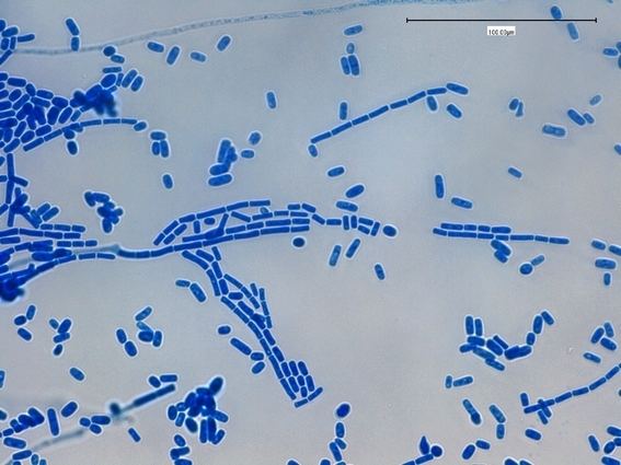 Geotrichum Fun With Microbiology What39s Buggin39 You Geotrichum candidum